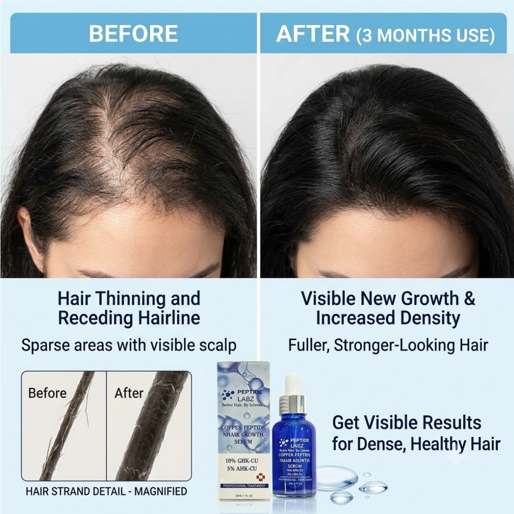 เอสเซนส์บำรุงเส้นผม คอปเปอร์ เ - Hair Care Elseve บทวิจารณ์และราคา