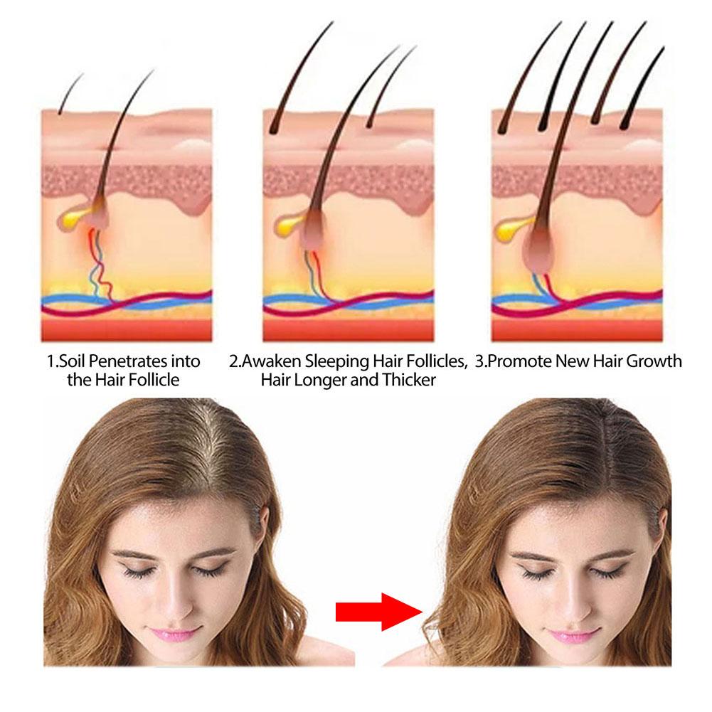โรสแมรี่แชมพูสบู่ขิง/ไม้ไผ่/ลา - Hair Care Elseve บทวิจารณ์และราคา
