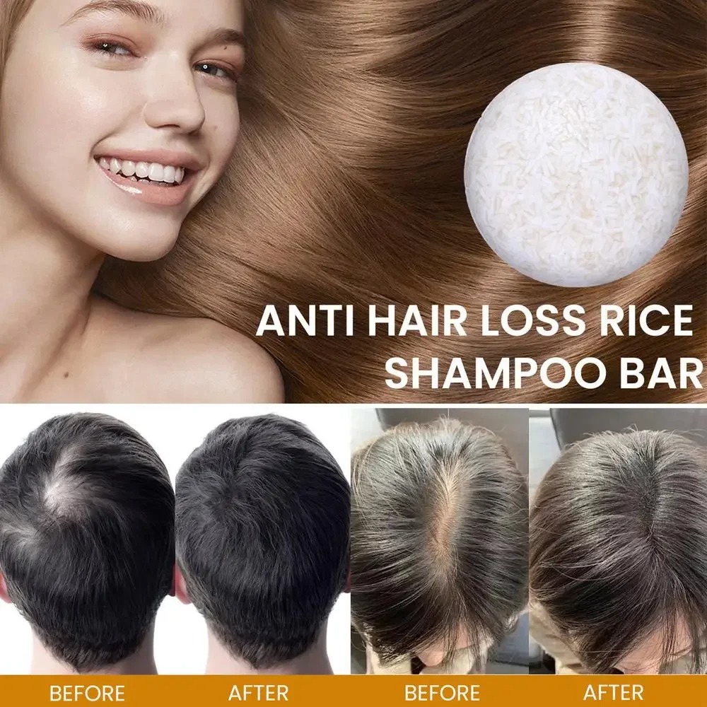 ข้าวอินทรีย์แชมพูสบู่บาร์น้ําม - Hair Care Elseve บทวิจารณ์และราคา
