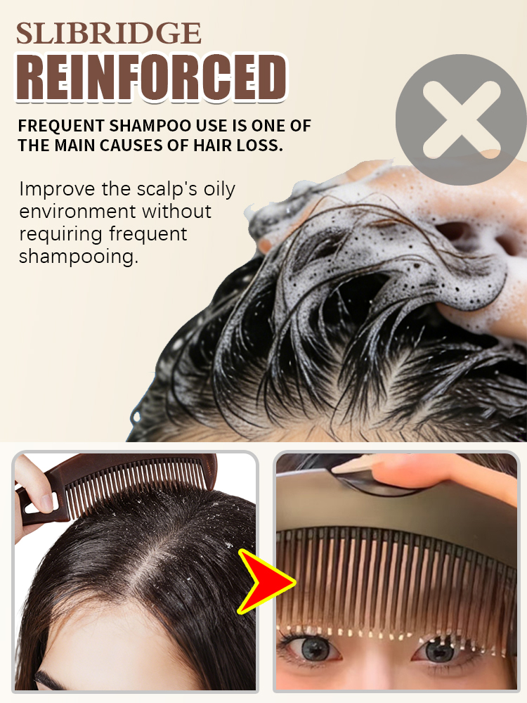 หวีกำจัดน้ำมันหนังศีรษะ หวีกำจ - Hair Care Dandruff บทวิจารณ์และราคา
