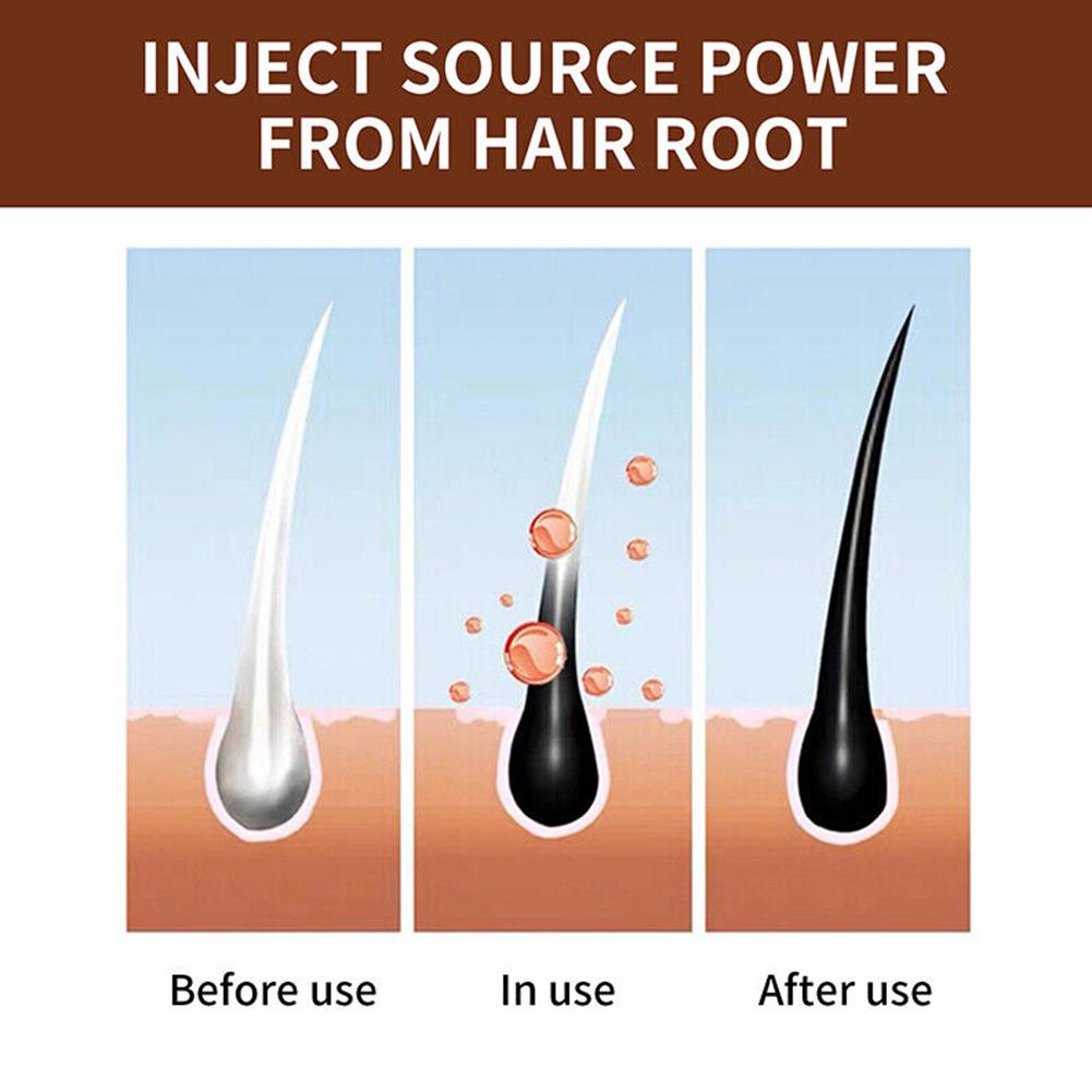 สบู่โพลีโกนัมธรรมชาติทำมือ ทำค - Hair Care Dandruff บทวิจารณ์และราคา